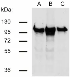 Anti-beta Catenin antibody [EM-22] used in Western Blot (WB). GTX80159