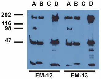 Anti-EGFR (phospho Tyr1173) antibody [EM-13] used in Immunoprecipitation (IP). GTX80161