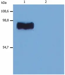 Anti-STIM1 antibody [CDN3H4] used in Western Blot (WB). GTX80195