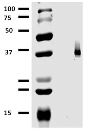 Anti-EpCAM antibody [323/A3] used in Western Blot (WB). GTX80286
