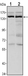 Anti-KDM3A antibody [2E1] used in Western Blot (WB). GTX80406
