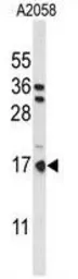 Anti-PTMS antibody, C-term used in Western Blot (WB). GTX80442