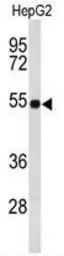 Anti-EFEMP2 antibody, C-term used in Western Blot (WB). GTX80452