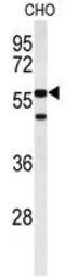 Anti-ACTR5 antibody, C-term used in Western Blot (WB). GTX80453