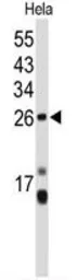 Anti-CENPH antibody, Internal used in Western Blot (WB). GTX80491