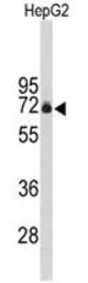 Anti-FBXO3 antibody, C-term used in Western Blot (WB). GTX80503