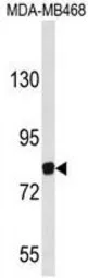Anti-EVI5 antibody, Internal used in Western Blot (WB). GTX80518