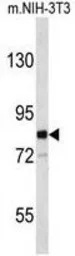 Anti-EVI5 antibody, Internal used in Western Blot (WB). GTX80518