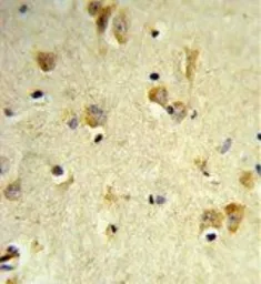 Anti-PEX14 antibody, C-term used in IHC (Paraffin sections) (IHC-P). GTX80530