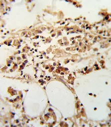 Anti-TIMP3 antibody, Internal used in IHC (Paraffin sections) (IHC-P). GTX80547