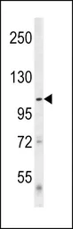 Anti-ULK1 antibody used in Western Blot (WB). GTX80551