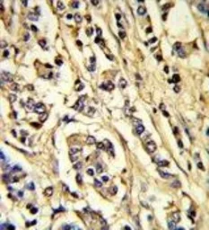 Anti-VEGF Receptor 2 antibody used in IHC (Paraffin sections) (IHC-P). GTX80591