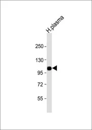 Anti-Factor B (Bb fragment) antibody, Internal used in Western Blot (WB). GTX80605