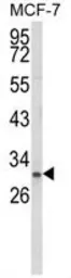 Anti-Nkx3.1 antibody, Internal used in Western Blot (WB). GTX80628