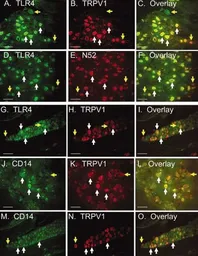 Anti-VR1/ TRPV1 antibody used in Immunohistochemistry (IHC). GTX80798