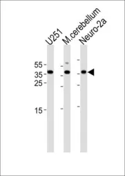 Anti-EMX1 antibody, C-term used in Western Blot (WB). GTX80913