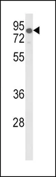 Anti-LDL Receptor antibody, Internal used in Western Blot (WB). GTX80914