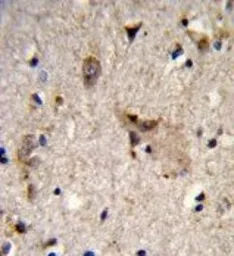 Anti-ALDH18A1 antibody, Internal used in IHC (Paraffin sections) (IHC-P). GTX80929