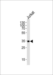 Anti-CD32a antibody, C-term used in Western Blot (WB). GTX80944