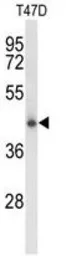 Anti-CLN5 antibody, N-term used in Western Blot (WB). GTX80945
