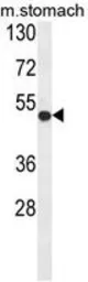 Anti-FERMT1 antibody, Internal used in Western Blot (WB). GTX80946
