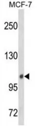 Anti-INPP4B antibody, Internal used in Western Blot (WB). GTX80952