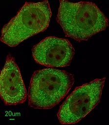 Anti-ALOX12 antibody, C-term used in Immunocytochemistry/ Immunofluorescence (ICC/IF). GTX80966