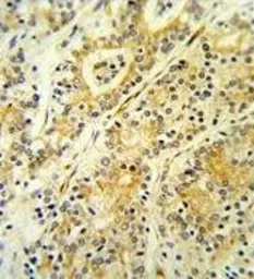 Anti-MGST2 antibody, C-term used in IHC (Paraffin sections) (IHC-P). GTX80967