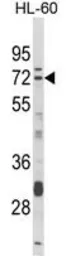 Anti-DTX4 antibody, N-term used in Western Blot (WB). GTX80971