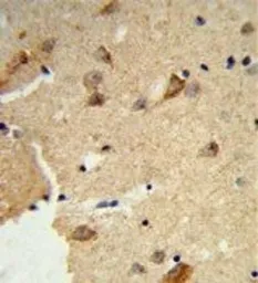Anti-DTX4 antibody, N-term used in IHC (Paraffin sections) (IHC-P). GTX80971