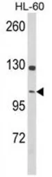 Anti-Dynamin 3 antibody, Internal used in Western Blot (WB). GTX80993