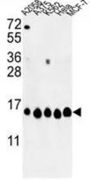 Anti-Histone H2A type 1H antibody, N-term used in Western Blot (WB). GTX81004