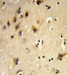 Anti-Histone H2A type 1H antibody, N-term used in IHC (Paraffin sections) (IHC-P). GTX81004