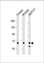 Anti-Glutaminase antibody, C-term used in Western Blot (WB). GTX81012