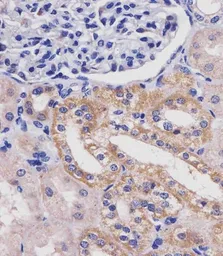 Anti-Glutaminase antibody, C-term used in IHC (Paraffin sections) (IHC-P). GTX81012