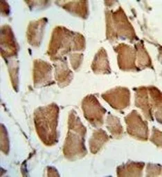 Anti-Tafazzin / TAZ antibody, N-term used in IHC (Paraffin sections) (IHC-P). GTX81015