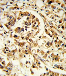 Anti-IL12A / IL12 p35 antibody, C-term used in IHC (Paraffin sections) (IHC-P). GTX81020