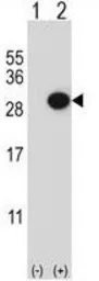 Anti-CTHRC1 antibody, N-term used in Western Blot (WB). GTX81033