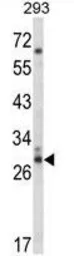 Anti-CDC42EP3 antibody, N-term used in Western Blot (WB). GTX81035