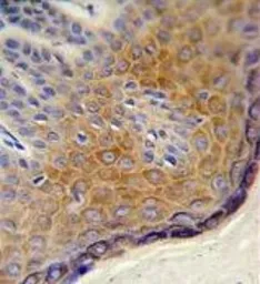 Anti-DERA antibody, N-term used in IHC (Paraffin sections) (IHC-P). GTX81043
