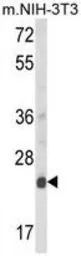 Anti-Derlin 1 antibody, C-term used in Western Blot (WB). GTX81054