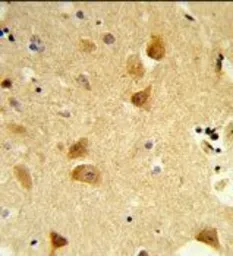 Anti-Derlin 1 antibody, C-term used in IHC (Paraffin sections) (IHC-P). GTX81054