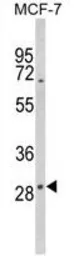 Anti-DIO2 antibody, Internal used in Western Blot (WB). GTX81072