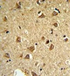 Anti-DIO2 antibody, Internal used in IHC (Paraffin sections) (IHC-P). GTX81072