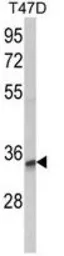 Anti-TSPAN12 antibody, C-term used in Western Blot (WB). GTX81087
