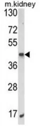 Anti-ALKBH3 antibody, C-term used in Western Blot (WB). GTX81095