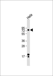 Anti-ATF6 antibody, Internal used in Western Blot (WB). GTX81096