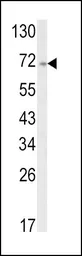 Anti-ATF6 antibody, Internal used in Western Blot (WB). GTX81096