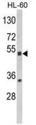 Anti-PXR antibody, Internal used in Western Blot (WB). GTX81102