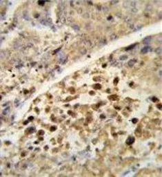 Anti-PXR antibody, Internal used in IHC (Paraffin sections) (IHC-P). GTX81102